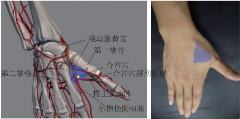 掌骨和第二掌骨交汇处的"径向顶点"作为远端桡动脉穿刺的骨性定位标志